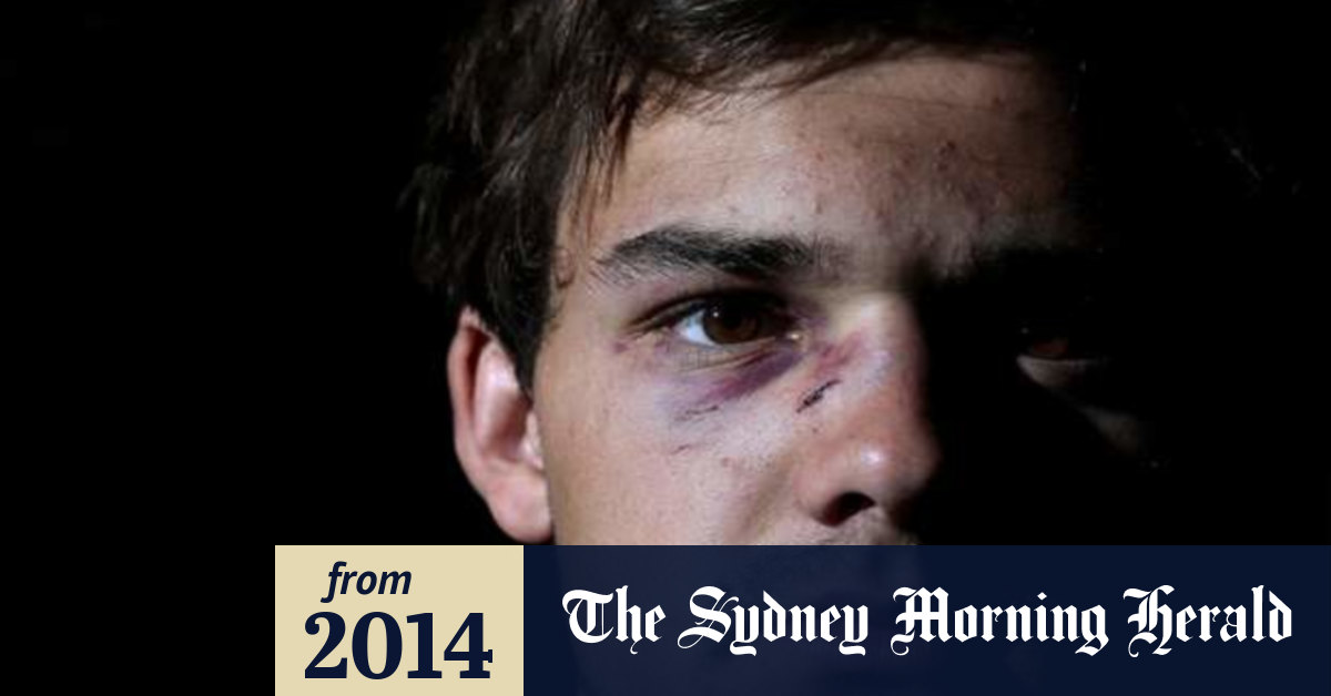 Confusion on charges for player alleged to have wiped blood on referee